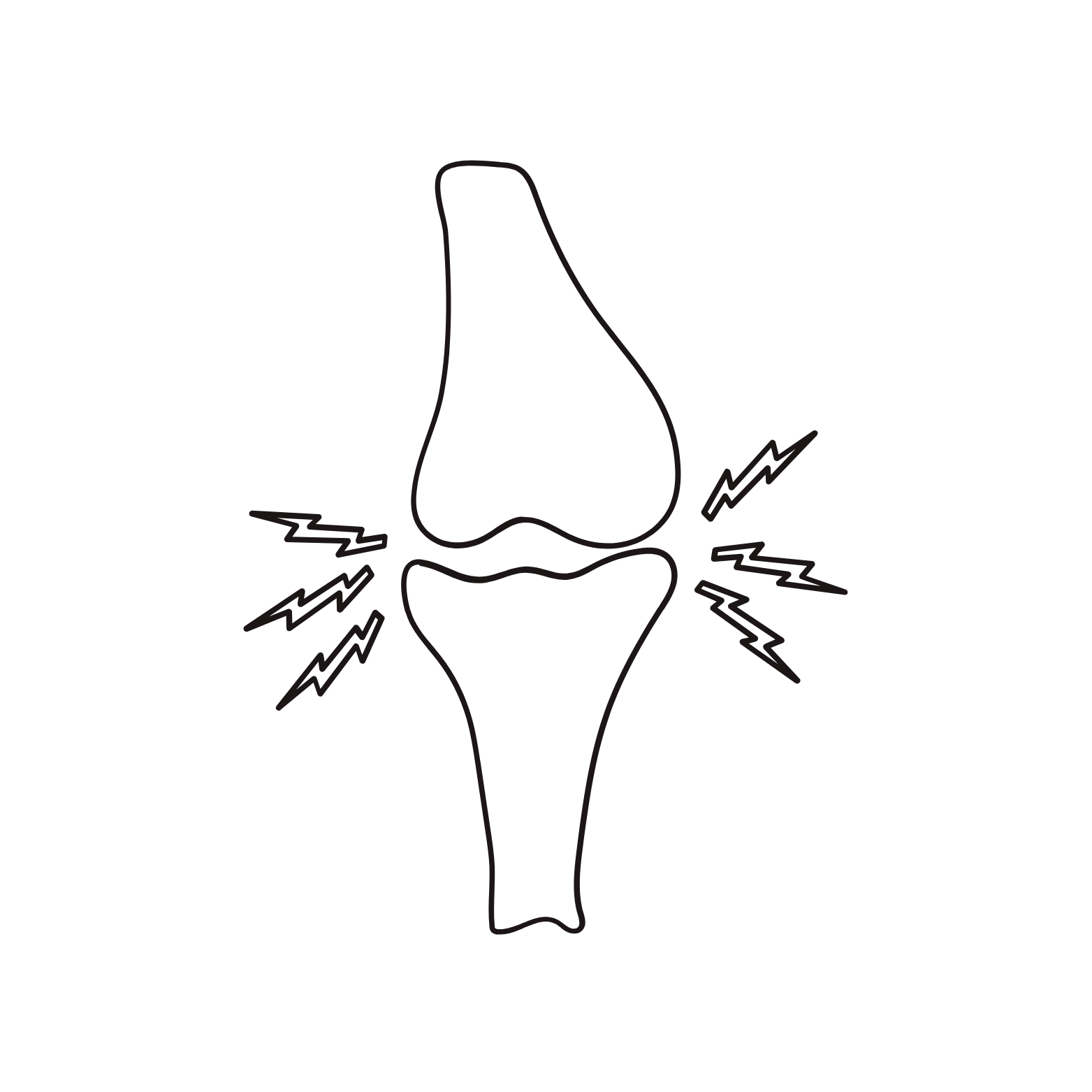 Arthritis