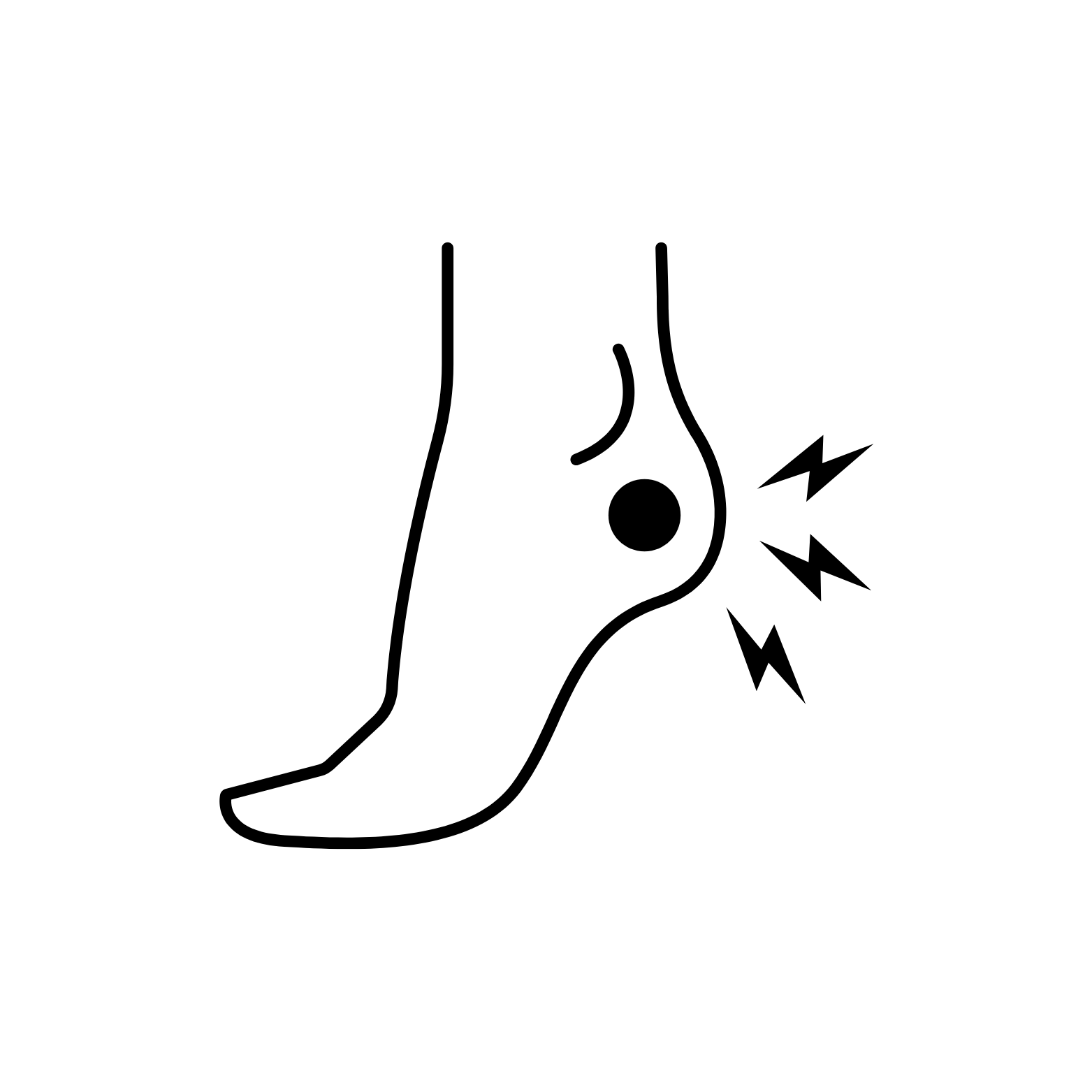 heel pain